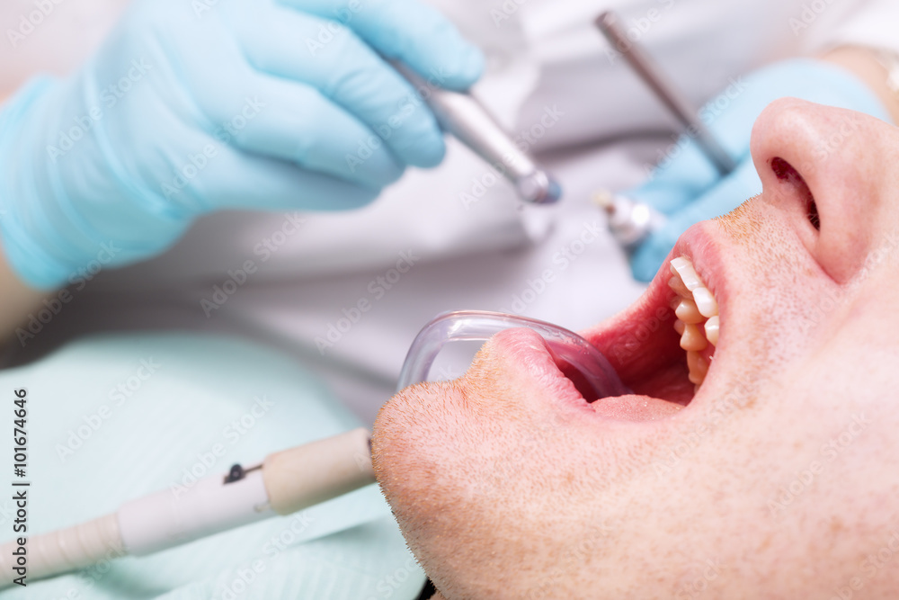 Fotografie Dentist's hand with a gloves and tools