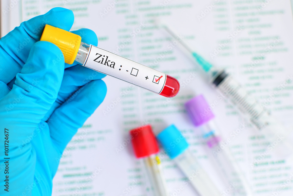Naklejka premium Blood sample positive with Zika virus