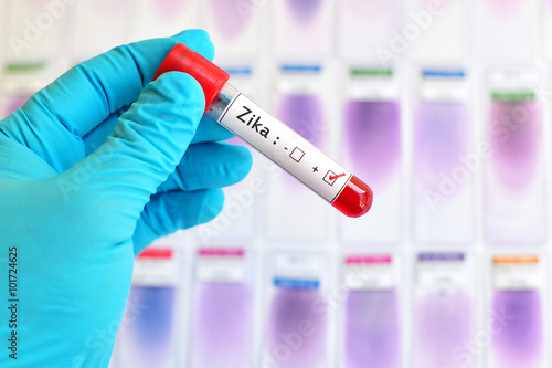 Blood sample positive with Zika virus