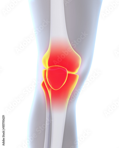 Painful Knee Illustration photo