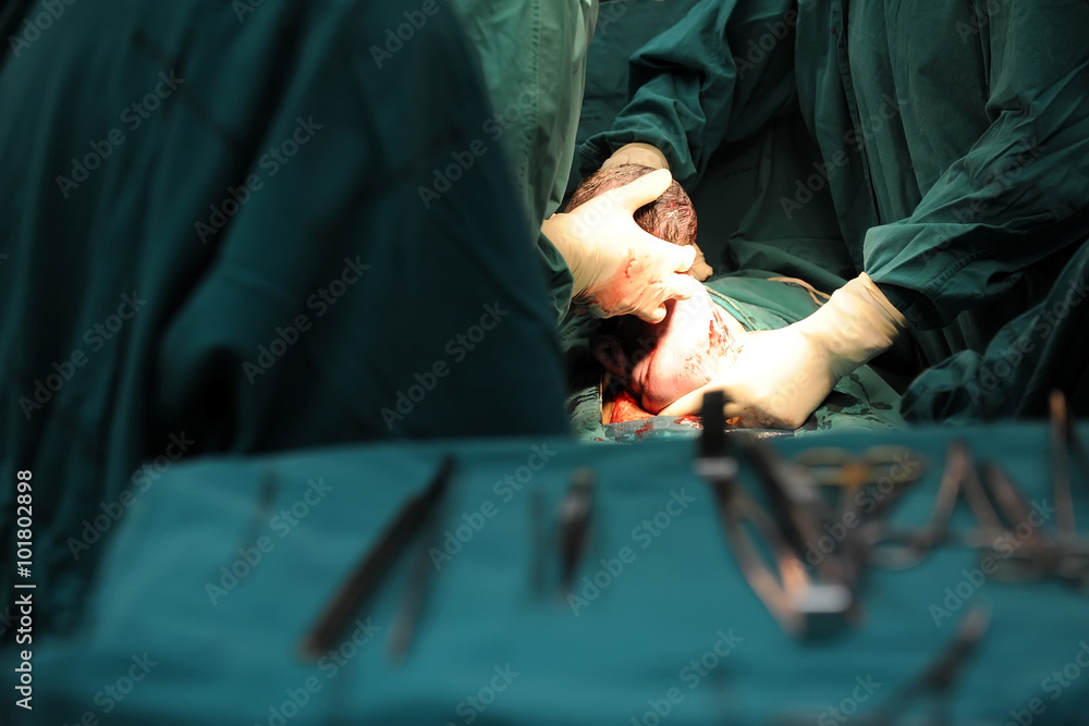 Baby being born via Cesarean Section