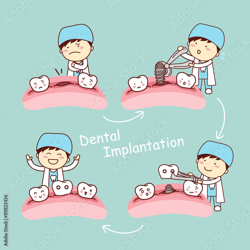 cartoon tooth dental implantation concept