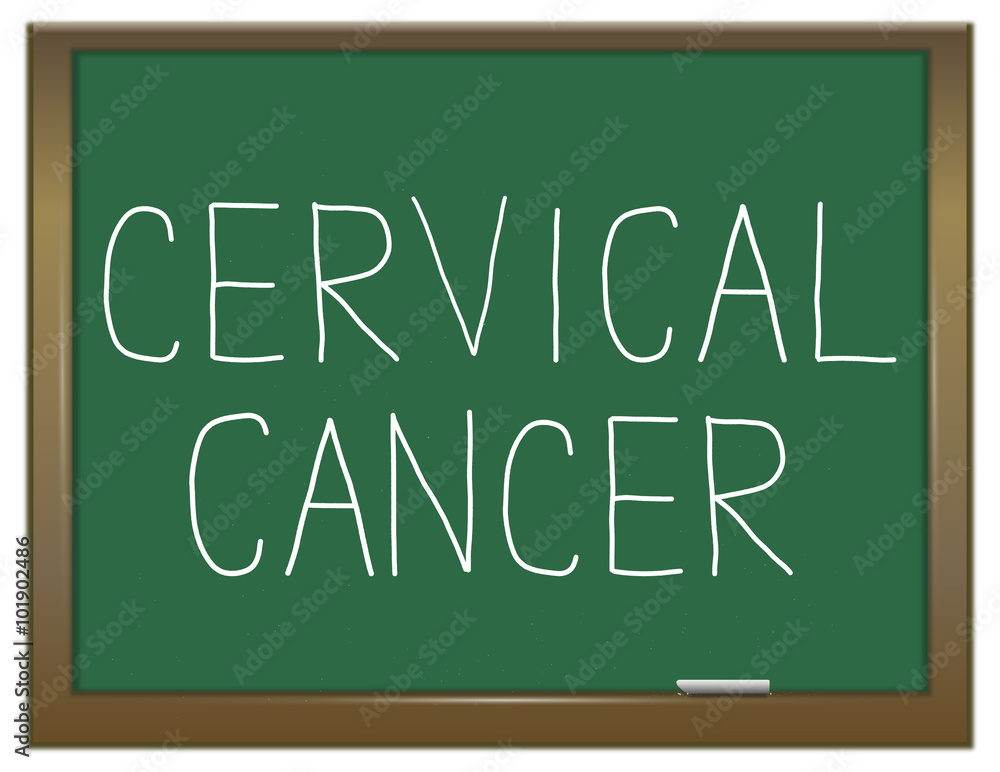Cervical cancer concept.