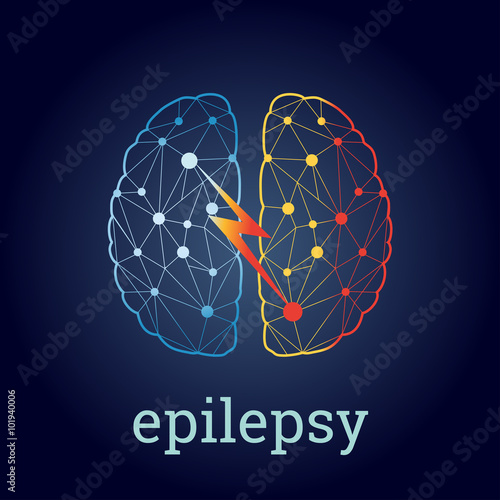 vector illustration of the brain with activity in one part