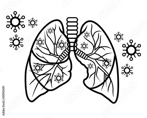 H1N1