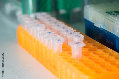 Biological sample in small centrifugal tubes placing in orange plastic rack