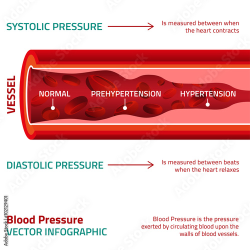 Blood Pressure Infographic