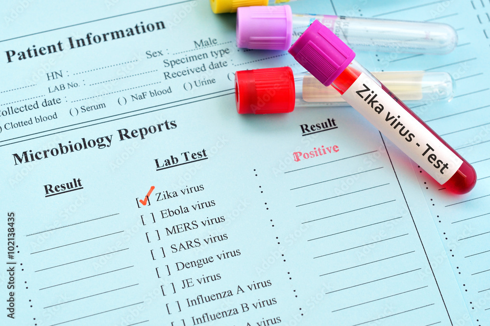 Zika virus positive result
Zika virus positive result