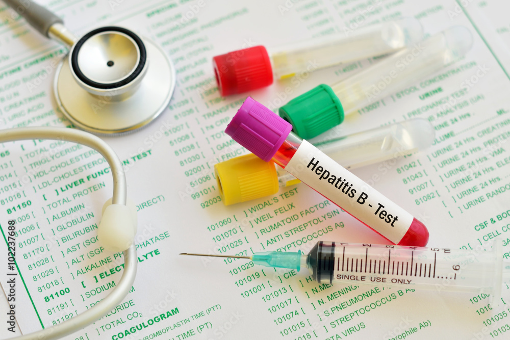 Hepatitis B virus test

