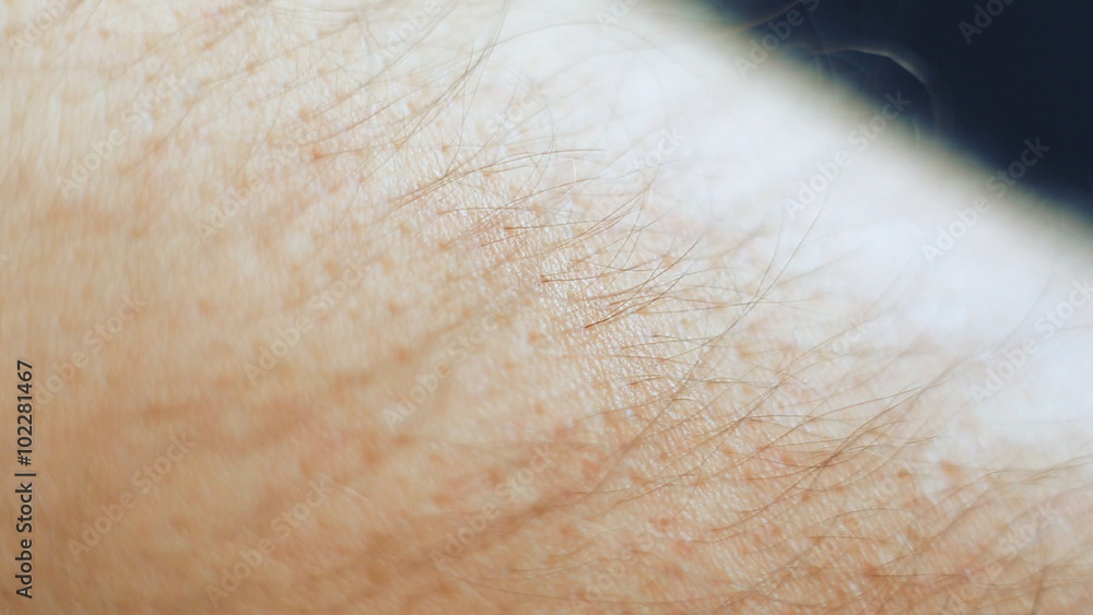 Male hands. skin of arms close-up, hairs macro. Male hands. skin of arms close-up, hairs macro.