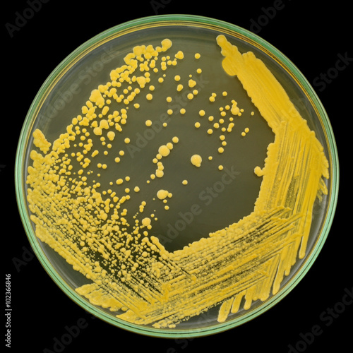 Yellow bacterial colonies on a petri plate ( dish ) isolated on a black background. 