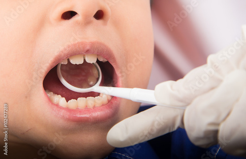 Little sibling boy pretend as a dentist close up inside mouth check up