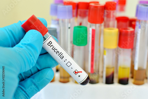 Blood sample positive with Brucella bacteria infected test
 photo