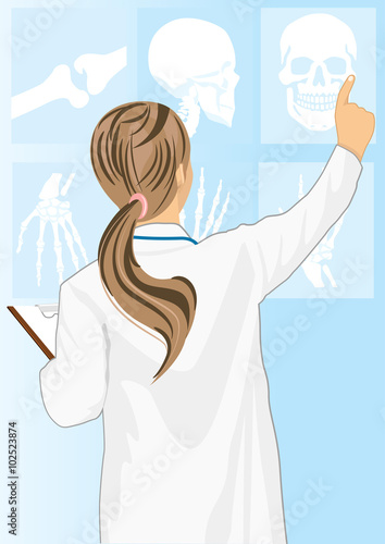 Medical doctor woman pointing on tomography