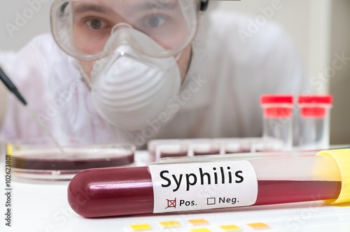 Test tube with blood for Syphilis test in front of researcher.