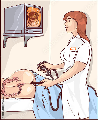 Vector illustration of a doctors who perform colonoscopy