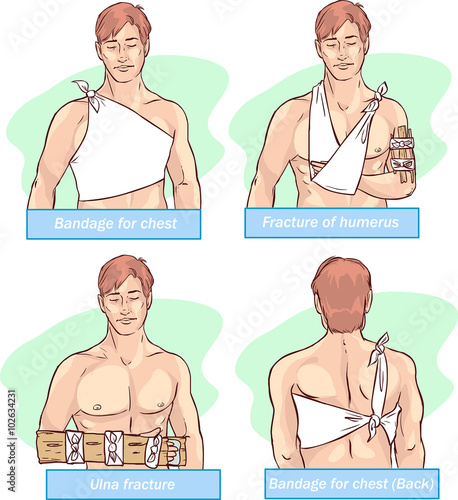 Vector illustration of abandage for chest ,fracture of humerus,u