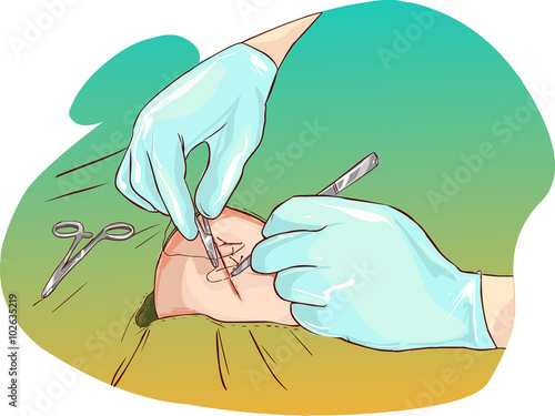 vector illustration of a Scar on a elbow illustration