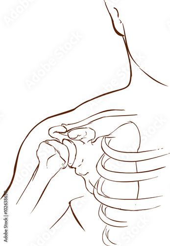 white background vector illustration of a shoulder dislocation
