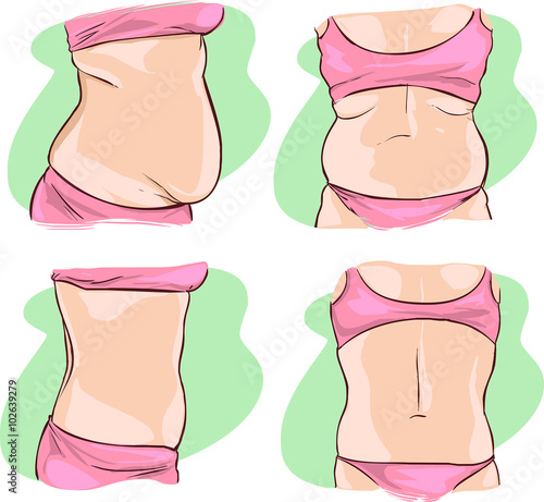 vector illustration of a Fat belly before and after treatment.