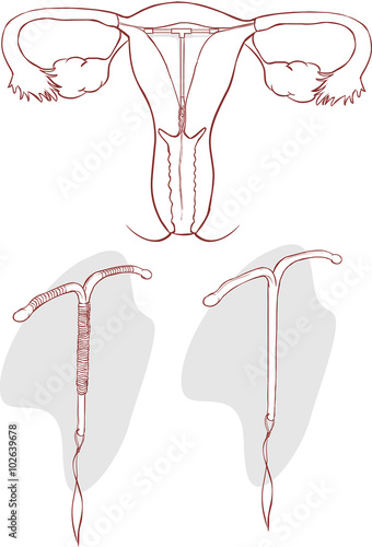 white backgroundvector illustration of a Installing illustration