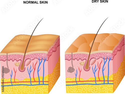 Illustration of The layers normal skin and dry skin