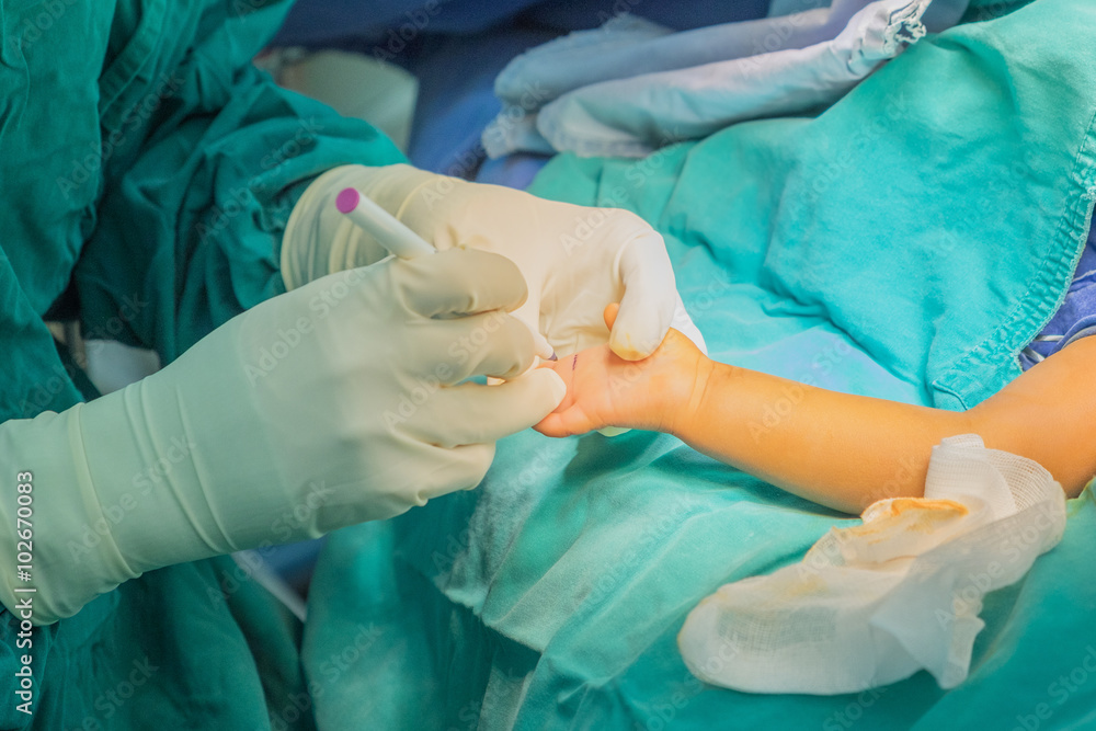 hand surgery hand surgery