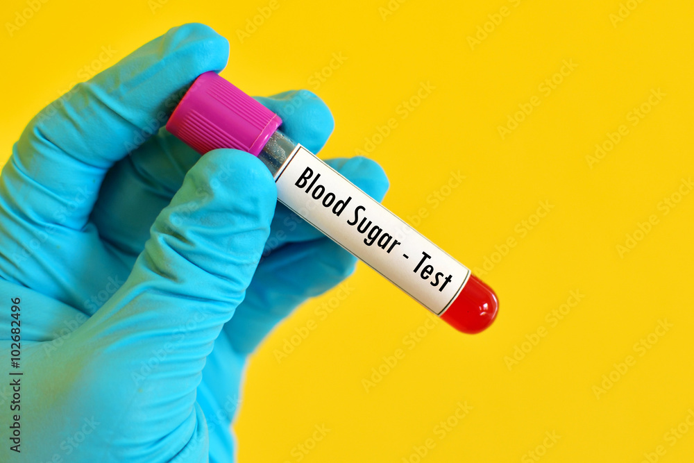 Obraz premium Blood sugar test