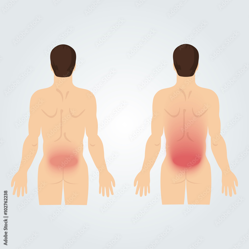 Two silhouettes of men from the back: increased back pain. Two silhouettes of men from the back: increased back pain.