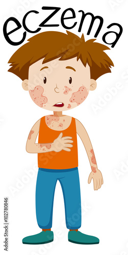 Sad boy with eczema