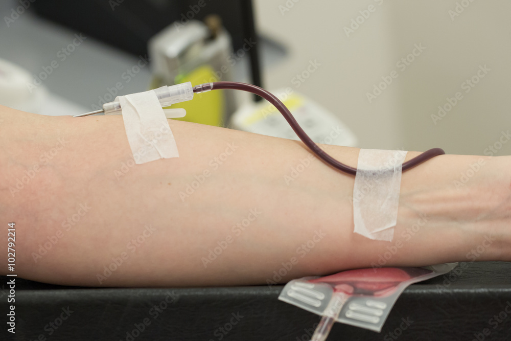 Donor in an armchair donates blood,, close-up
