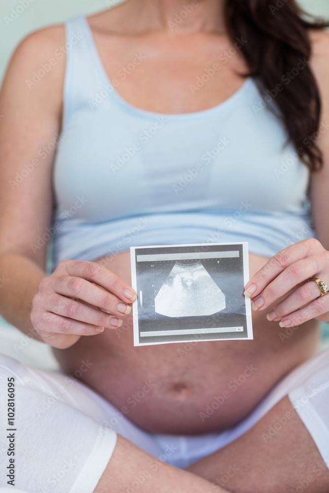 Pregnant woman showing ultrasound scan Pregnant woman showing ultrasound scan