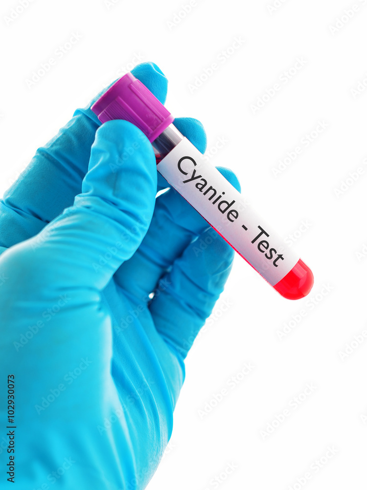 Fototapeta premium Test tube with blood sample for cyanide test 