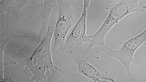 Movement, division and death of HeLa cervical cancer cells under microscope
