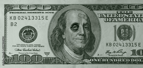 Ben Franklin with Black Eye and Band Aid on C-Note photo