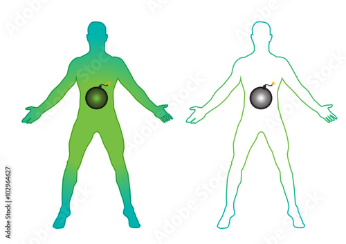 Abdominal pain illustration