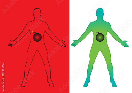 Abdominal pain illustration
