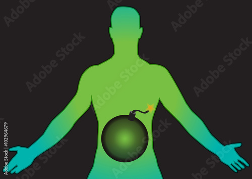 Abdominal pain illustration