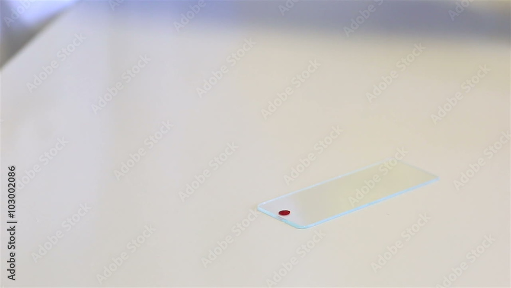 Preparation of smear. Applying a drop of blood on glass slide, and the erosion of its cover glass. Preparation of smear. Applying a drop of blood on glass slide, and the erosion of its cover glass.