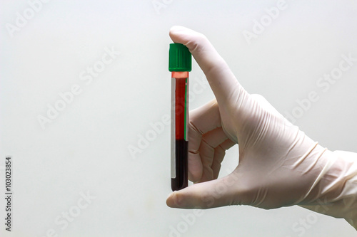 Hand with latex glove holding blood sample on white background