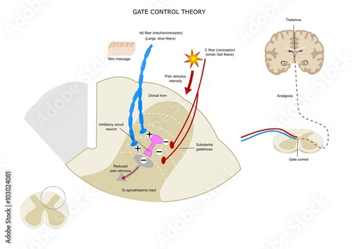 Gate control theory: how mechanoreceptor fibers can reduce a pain stimulus carried by C fibers