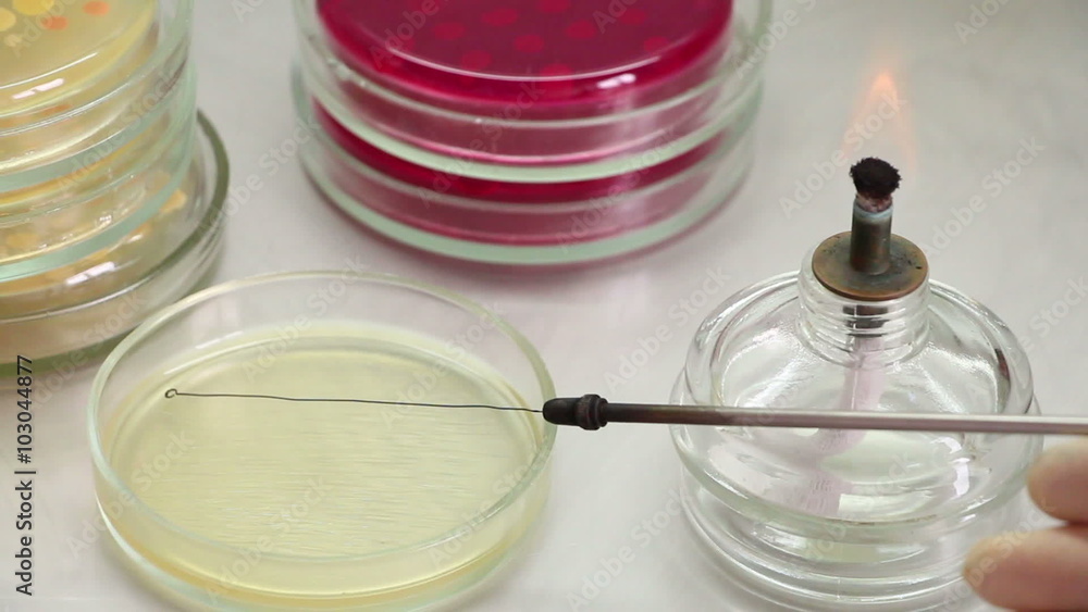 Microbiologist opens perti dish, inoculates agar surface by strokes of bacteriological loop and removes glassware. Lockdown. Point of view. Close-up. Microbiologist opens perti dish, inoculates agar surface by strokes of bacteriological loop and removes glassware. Lockdown. Point of view. Close-up.