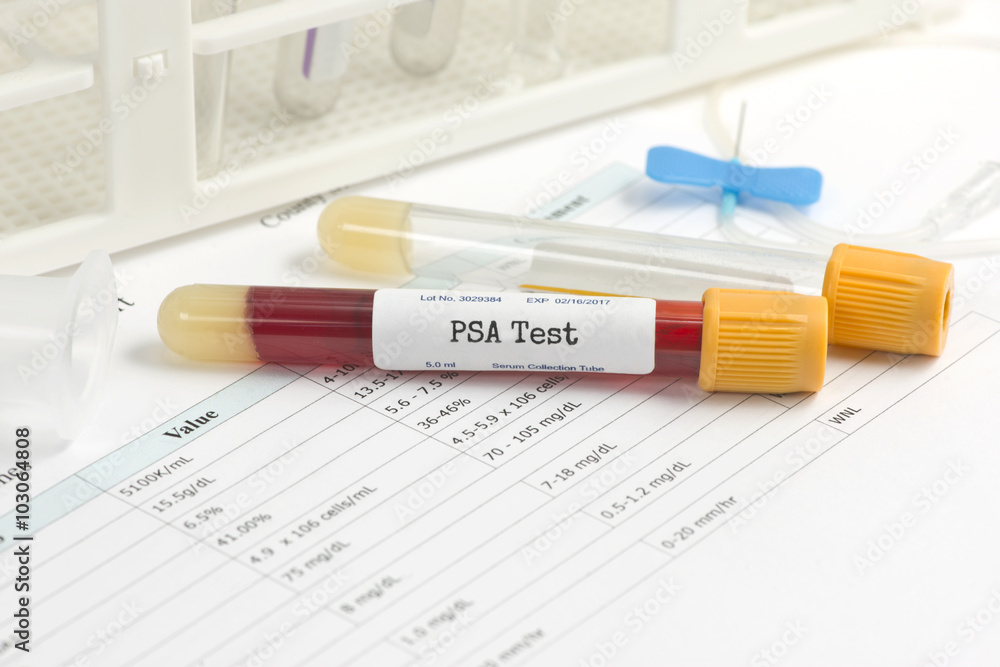 PSA Test PSA Test