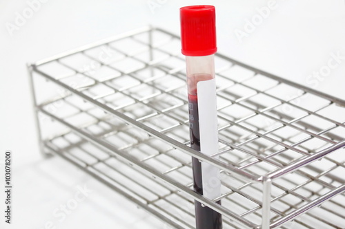 Blood sample in a test tube Vacutainer