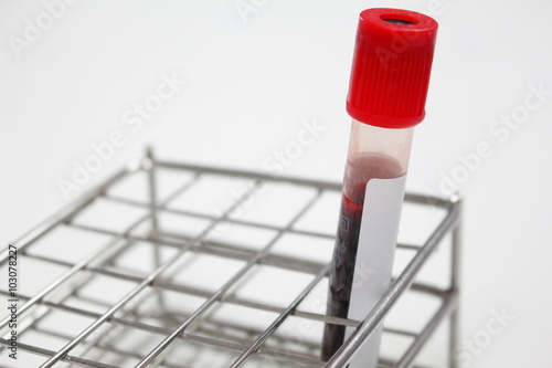 Blood sample in a test tube Vacutainer
