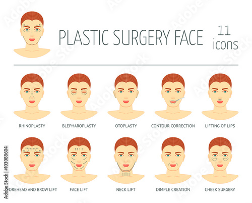 Set of plastic surgery face icons. Flat design. Vector