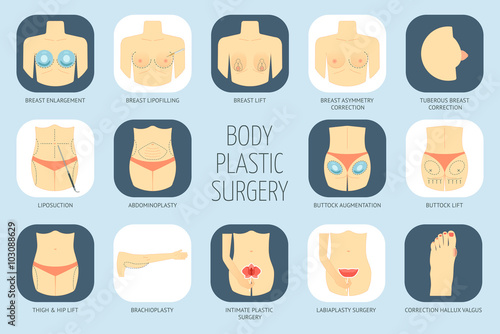 Plastic surgery body icons. Flat design. Vector