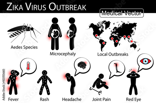 Zika virus outbreaks infographics ( Mosquito ( Aedes species ) is carrier , microcephaly in fetus , local area outbreak , symptom of zika fever )