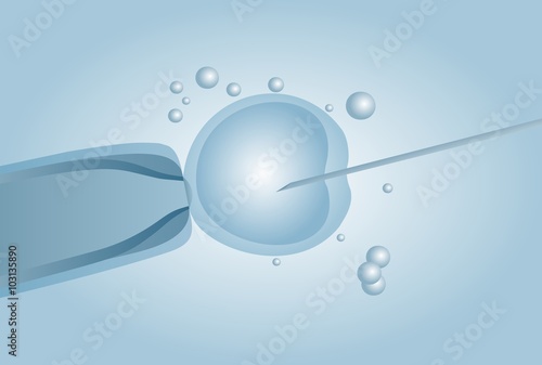 Microscopic artificial insemination, In vitro fertilisation IVF