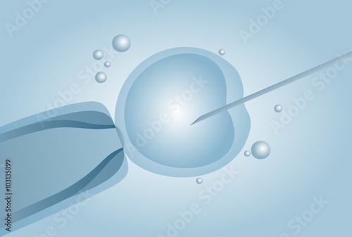 Microscopic artificial insemination, In vitro fertilisation IVF